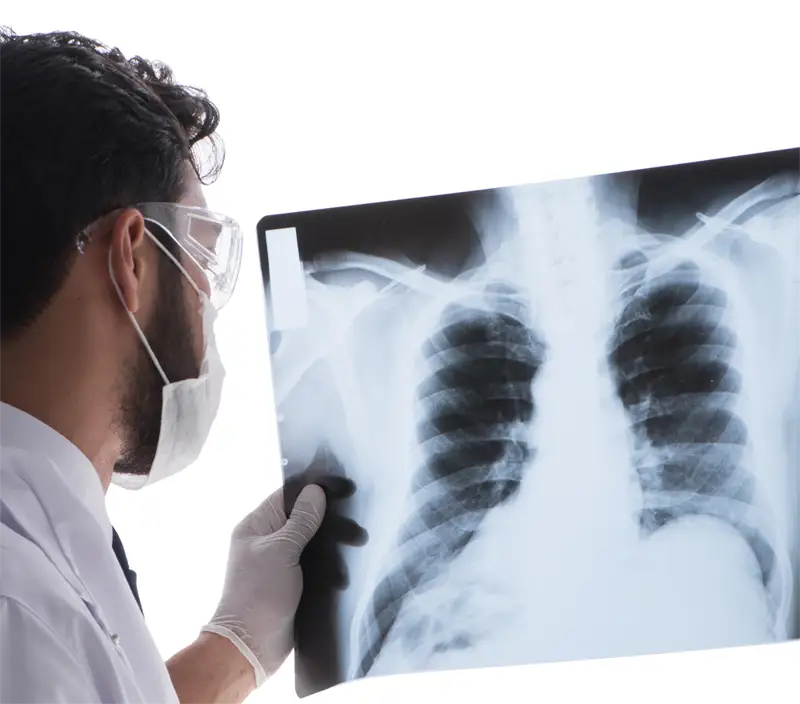 Man in surgical mask examining a chest xray